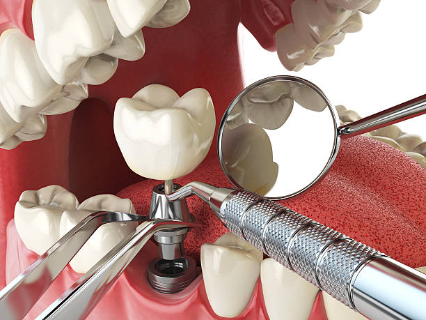 Best 24-Hour Emergency Dentist in Rankin, TX
